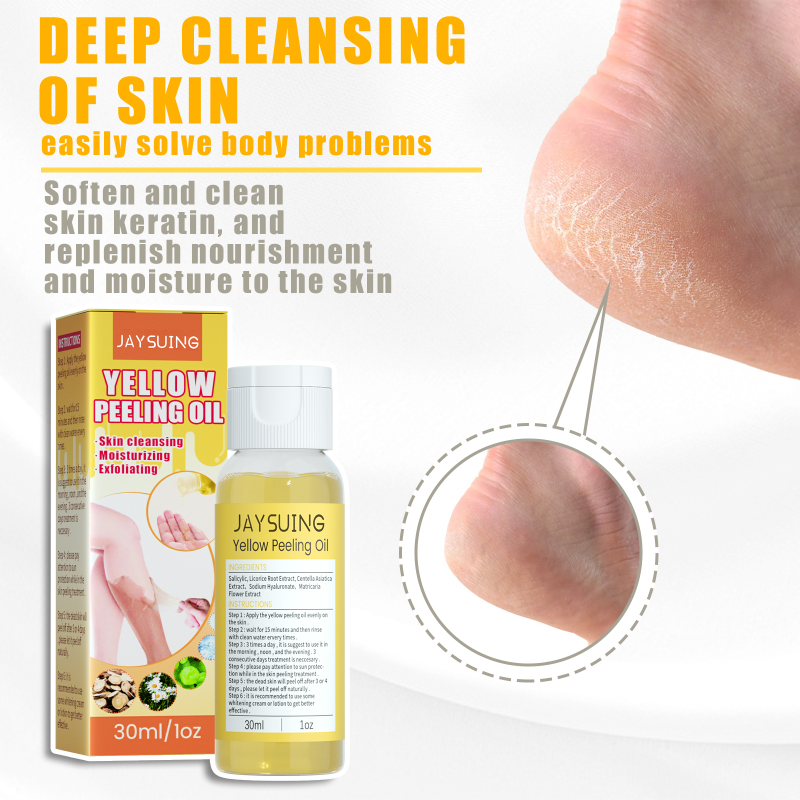 Giel Peeling Ueleg Däischter Haut Bleechung Ewechzehuelen Aarm Knéi Been Melanin Kierper Peeling Brightening Whitening Beauty S_voghion.com