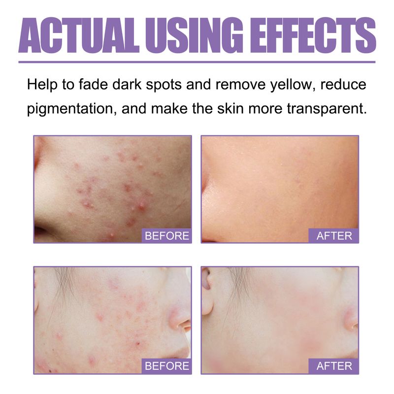 Ximonth Lavender Cleansing Soap Cleanses Facial Skin With Oil Control For Pores And Acne Moisturizing Cleanser_voghion.com