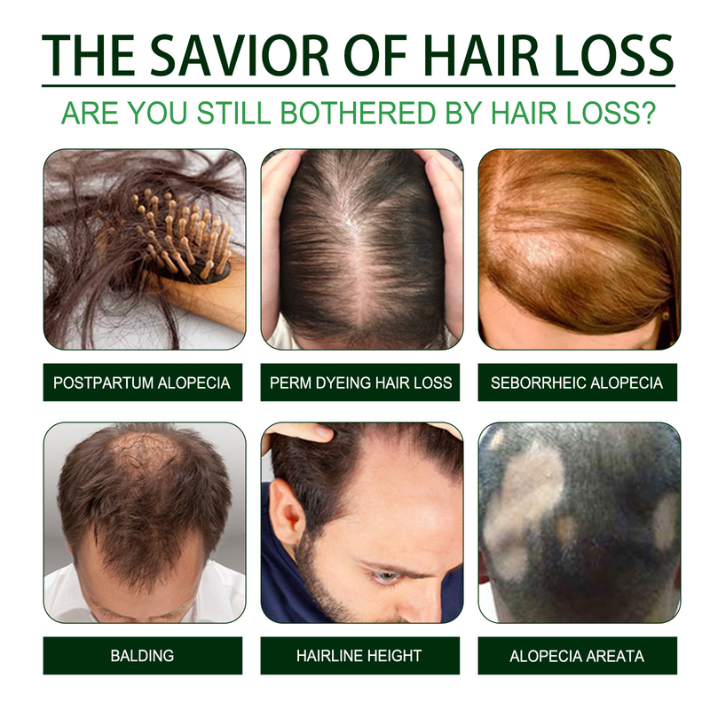 Hoegoa black castor essential oil dense delicate repairing smoothing hair, massaging the scalp and strengthening_voghion.com