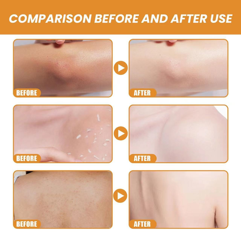 Hot sale orange cleaning pore lighting white temperature and blackhead defoliating gel_voghion.com