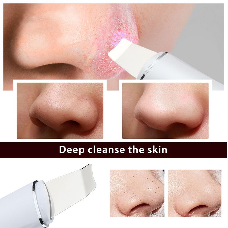 New ultrasonic household peeling machine, beauty instrument, pore cleaner, facial blackhead instrument_voghion.com