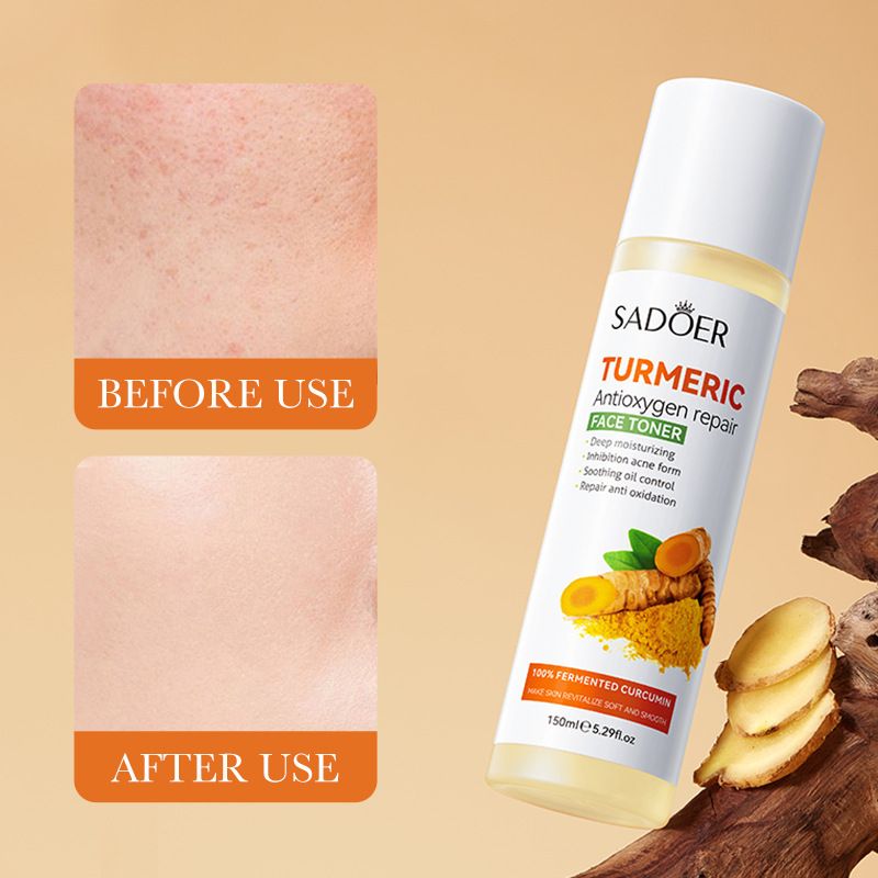 SADOER Tonico emolliente anti-ossigeno riparatore e idratante alla curcuma, restringente i pori_voghion.com