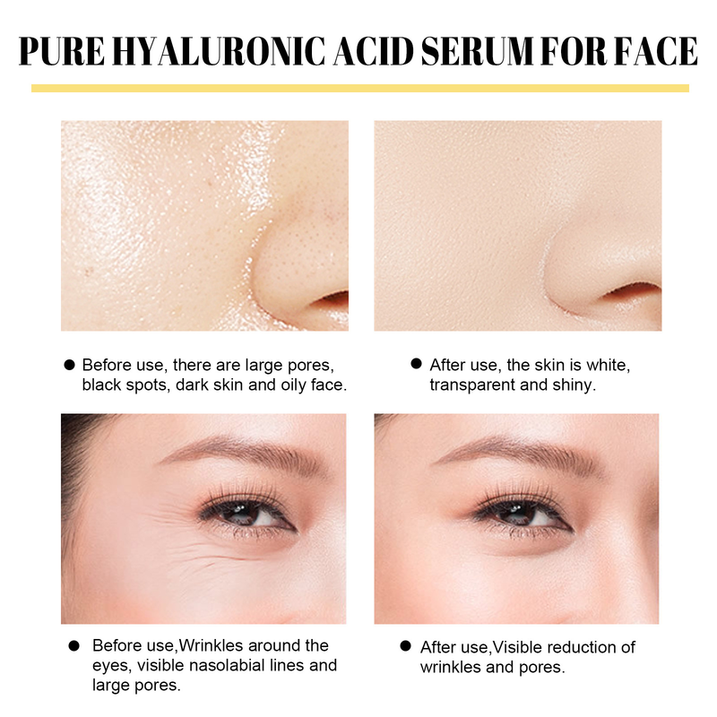 filo Bella proteina lifting e rassodante per ridurre le linee sottili e le rughe, modellare il viso, sollevare e_voghion.com