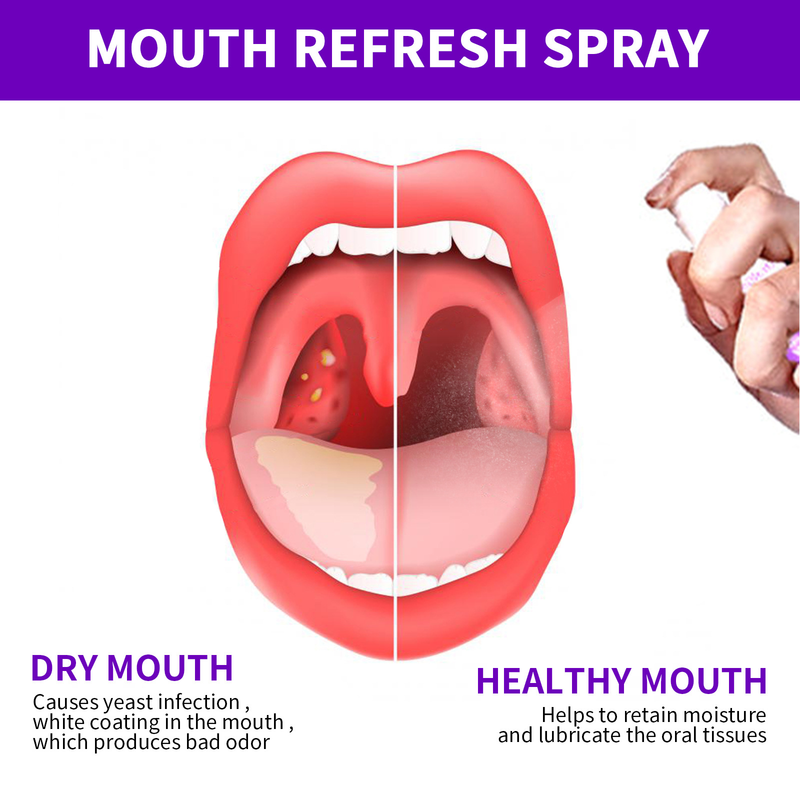 Mouth beautiful Fresh spray Clean bad breath Mouth odor Fresh breath Clean smell Keep fragrance Portable spray_voghion.com