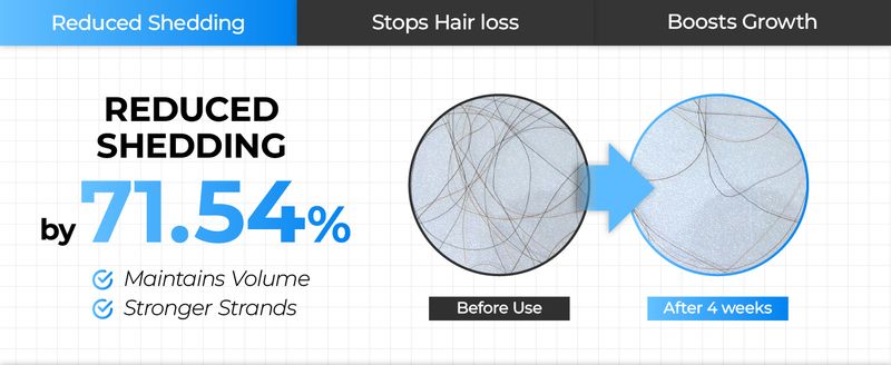 Siero per la crescita dei capelli Seapuri Scalpy, per la caduta dei capelli e il diradamento del cuoio capelluto, trattamento massaggiante per cuoio capelluto, esfoliante leggero e antiforfora._voghion.com