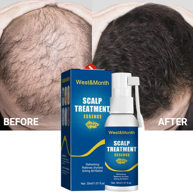 Växande 30ml Snabbt hår Serum Spray Anti Håravfall Behandling Essensolja Reparation Nära hårrötter Hårväxt Produ_voghion.com