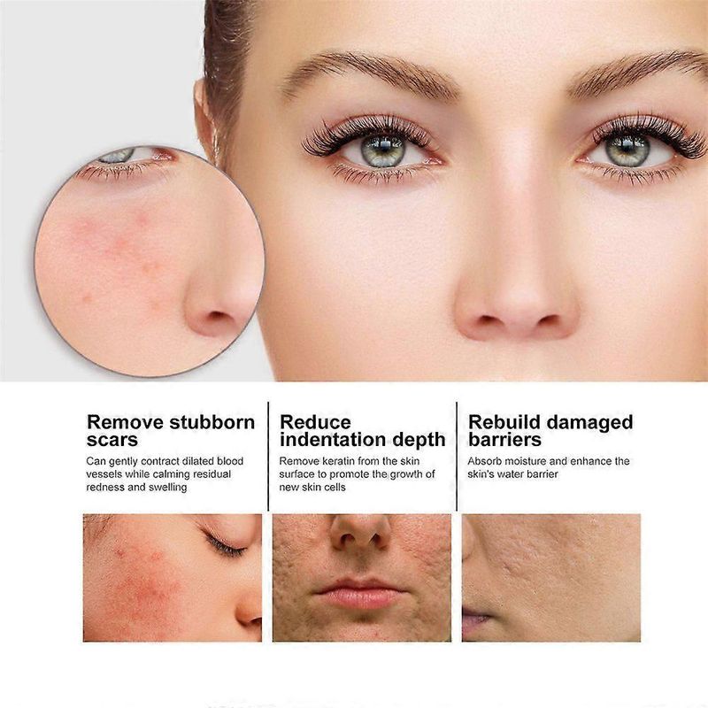 1-3 pezzi di siero schiarente efficace per rimuovere le macchie scure, le lentiggini, l'essenza anti-età, la niacinamide, attenua la pigmentazione, il melasma, illumina la cura della pelle_voghion.com