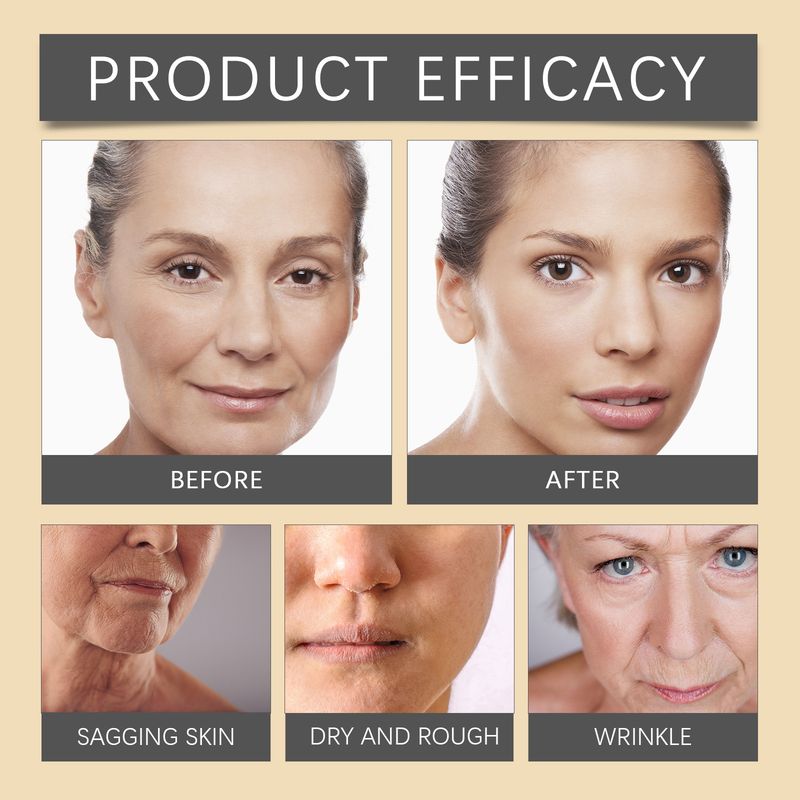 OUHOE Bee Venom Facial Care Cream Gently Moisturizes Brightens The Skin, Leaving It Delicate, Tender, And Soft_voghion.com