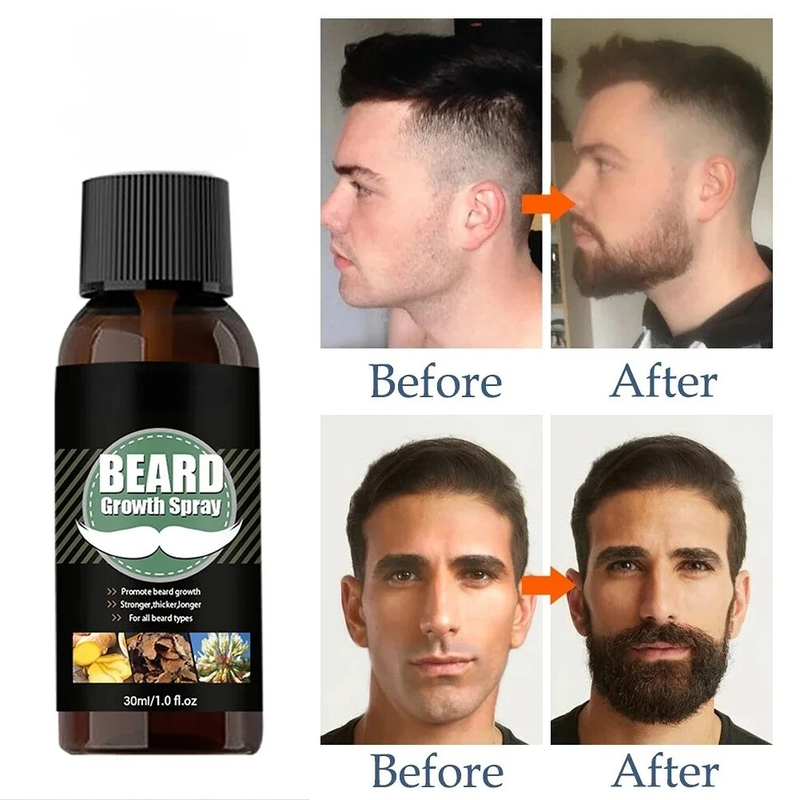 Männer Bartwachstum Ätherische Öle Essenz Spray Pflegendes und feuchtigkeitsspendendes Spray Bartpflege Pflegeöl Bartwachstum Sprühöl_voghion.com