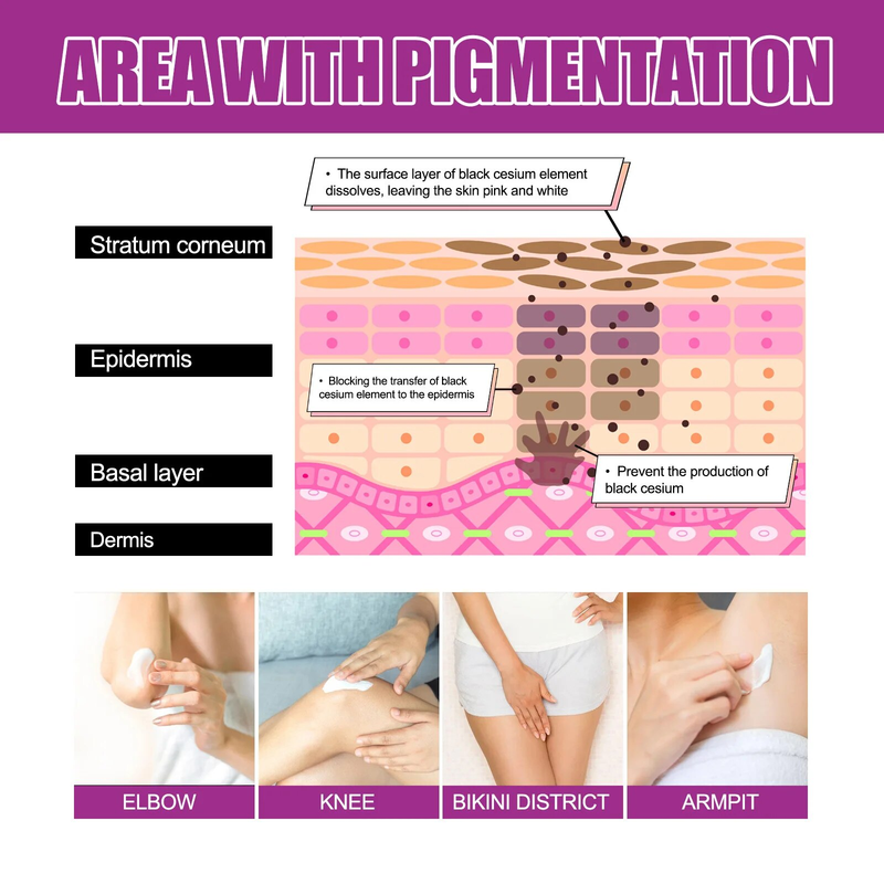 Lightening Intimate Areas Cream Brightening Private Parts Underarm Bleaching for Armpit Dark Skin Whitening Melanin Body Cream_voghion.com