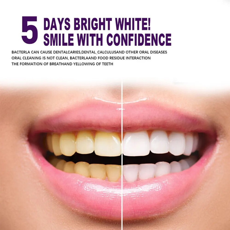 V34 Purple Whitening Tooth Paste Čistí ústa Svěží dech Odstraňuje žluté skvrny Chrání zuby White Dekontaminační péče 2023_voghion.com