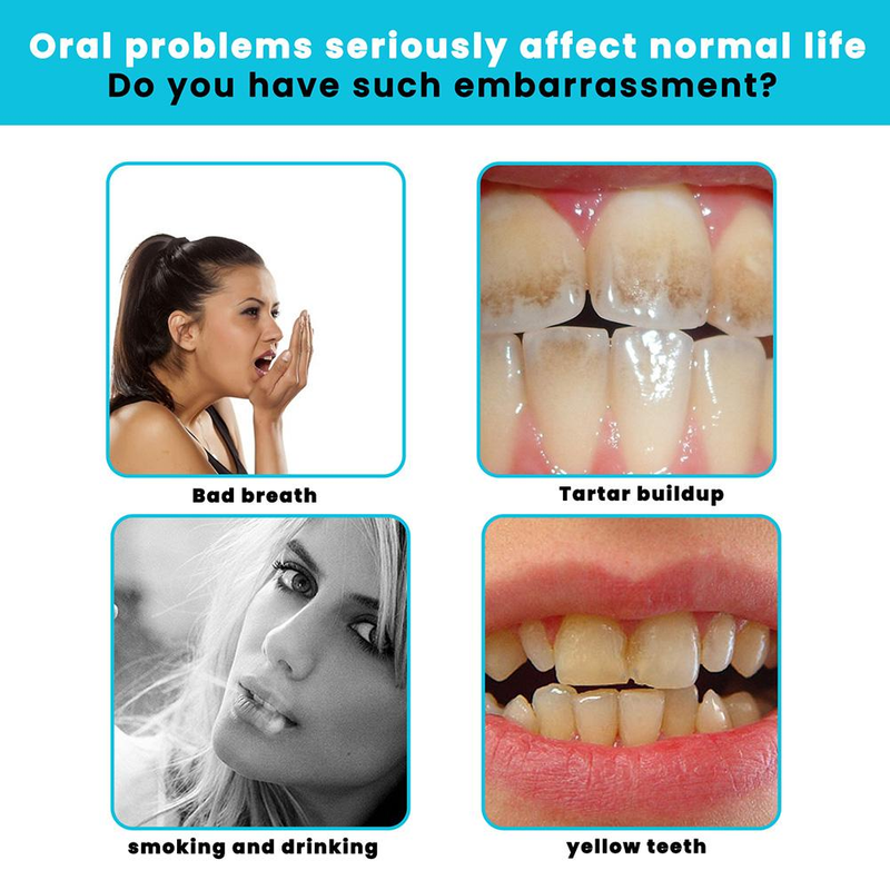 Mousse detergente Dentifricio Schiuma Dentifricio antimacchia Dentifricio bianco Sbiancante Teethaid Fresh Care Collutorio V4M2_voghion.com