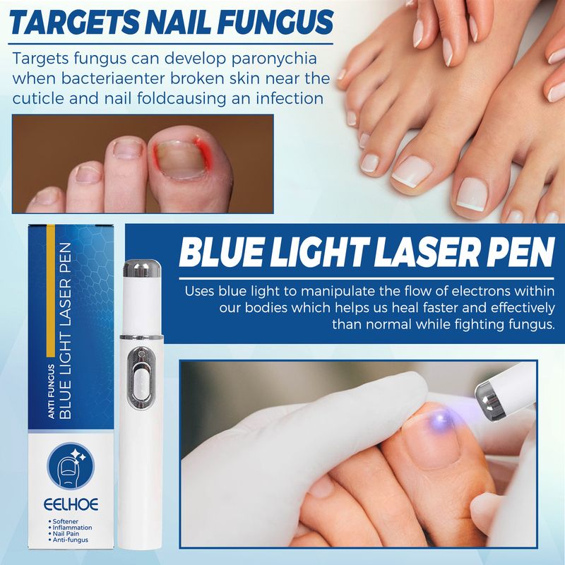 Blue Light Onychomycosis Laser Pen Simple And Easy To Use Odor Removal Nail Care_voghion.com