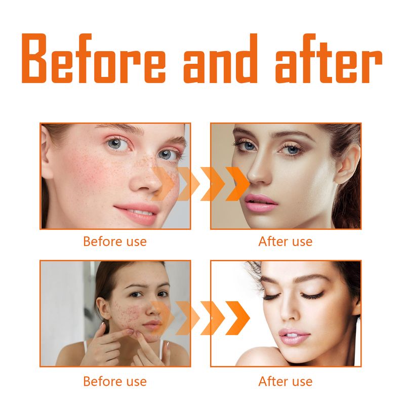 West&Month Turmeric Toner, Deep Hydrating Firming And Moisturizing Facial Skin Toner_voghion.com