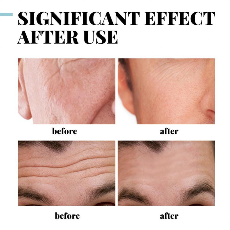 Mænd Ansigtscreme Anti Aging Fjern Rynker Opstrammende Lifting Whitening Creme Oplysende Fugtgivende ansigtshudplejecremer_voghion.com