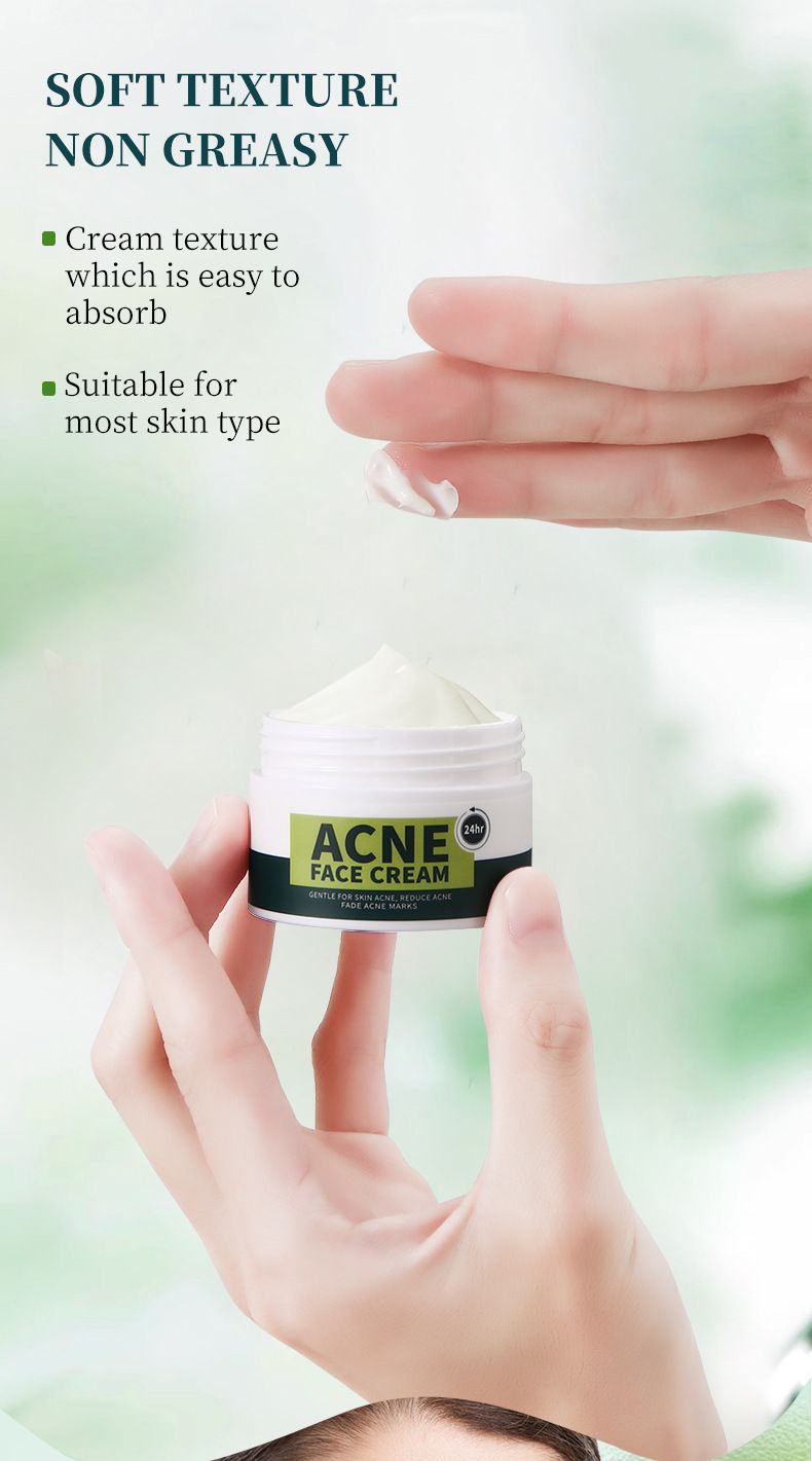 Treatments & Masks Anti Acne Facial Cream Moisturizing And Rejuvenating Acne Cream Facial Care_voghion.com