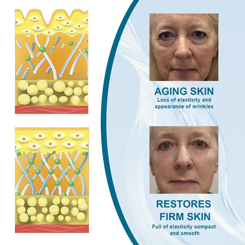 Siero viso Collagen Boost, rimozione macchie scure, rughe, anti-invecchiamento, lifting per occhi, idratante, prodotti per la cura della pelle coreana, 30 ml_voghion.com