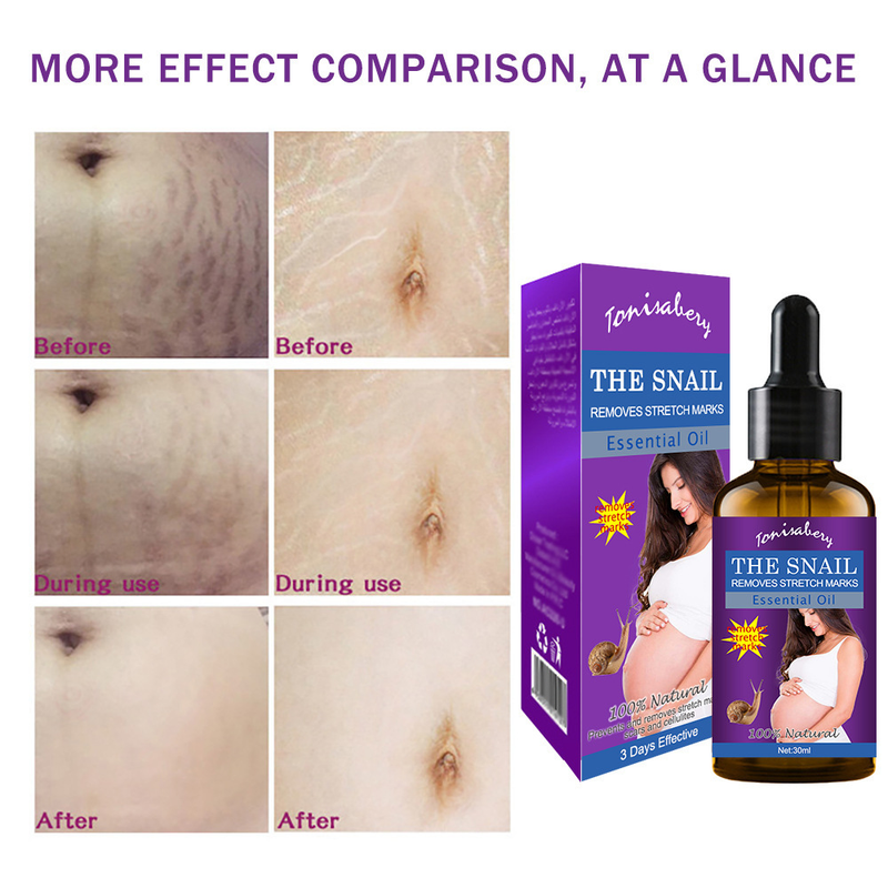 Specialize Vatsahierontaöljy synnytyksen jälkeiseen venytykseen 30ml_voghion.com