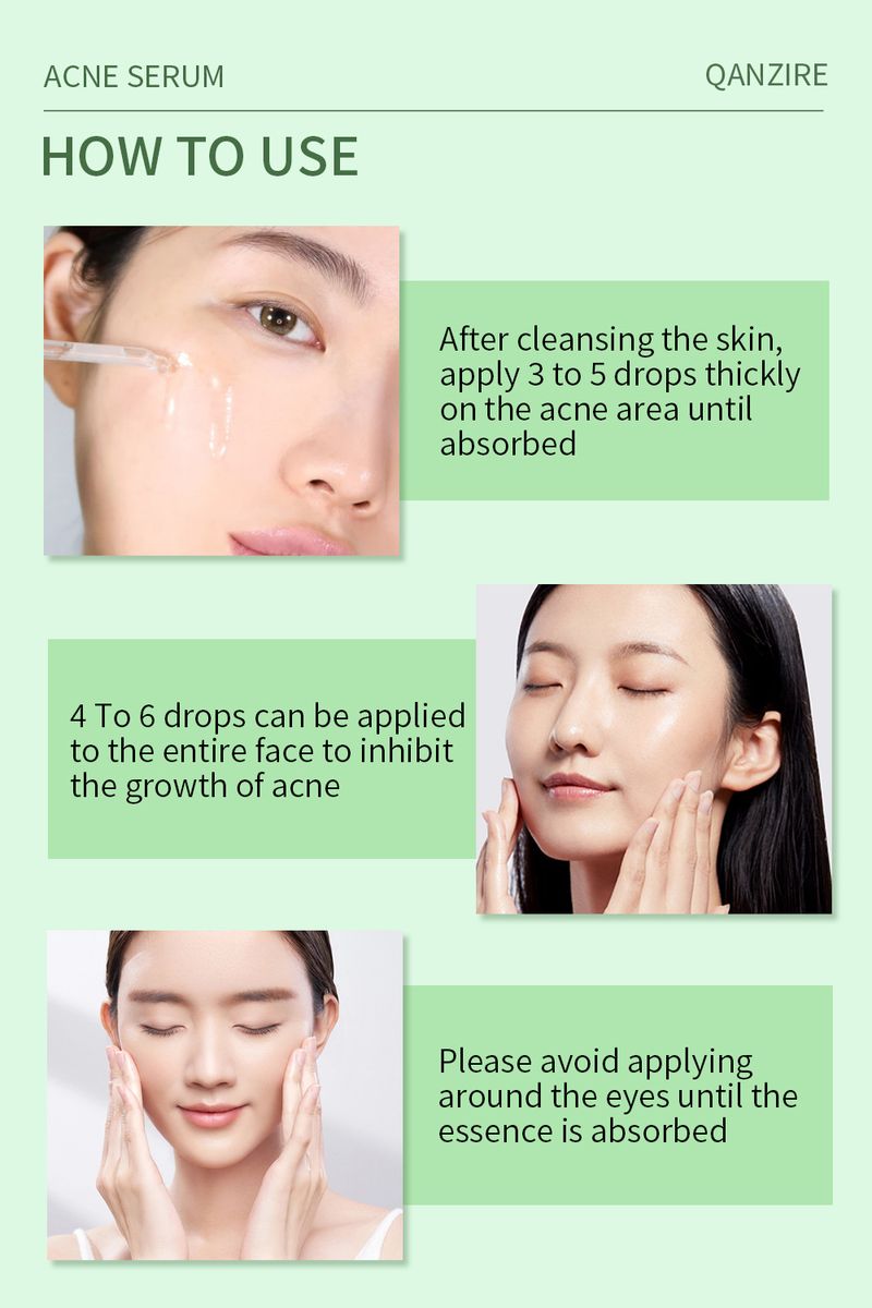 Anti-Akne-Serum, Essenz zur Behandlung von Akne, Pickeln und verstopften Poren – 30 ml_voghion.com