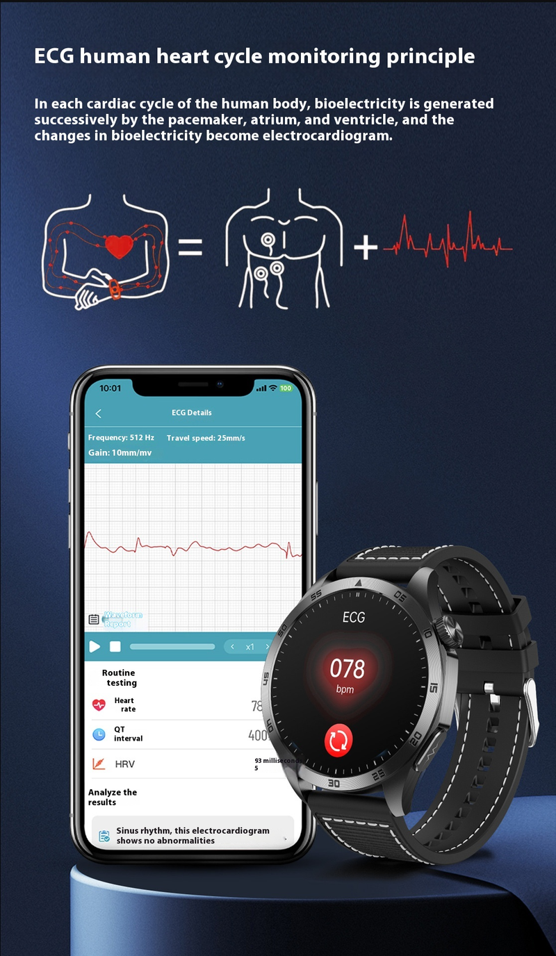 Smart Health Monitoring Watch - ECG ECG, Blood Sugar, Blood Oxygen, Sleep And Other Multi-functional Guardians_voghion.com