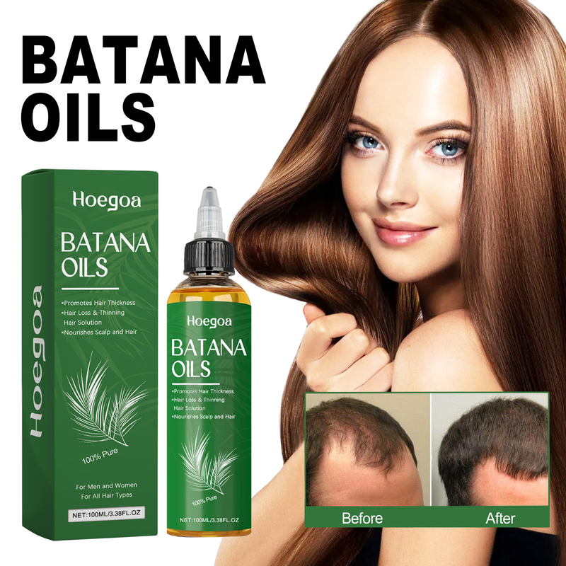 Hoegoa Moisturizes, Smooths, Repairs Roots, Strengths and Protects Batana Dense Hair Essence Oil_voghion.com