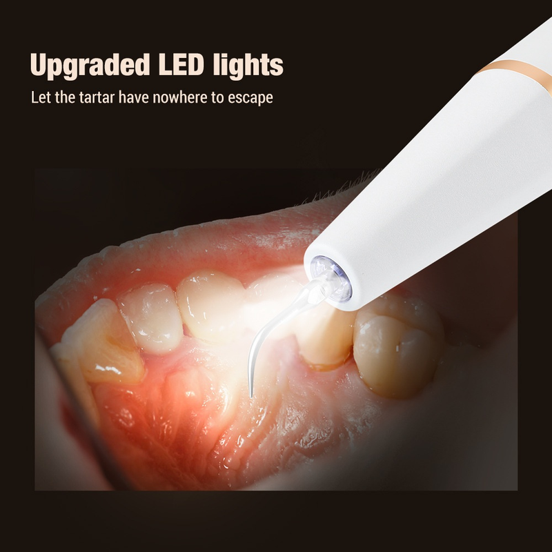 Zahnskala für den Haushalt, elektrisch, zum Entfernen von Teer und Teer. Echter Ultraschall-Zahnsteinentfernungsgerät_voghion.com