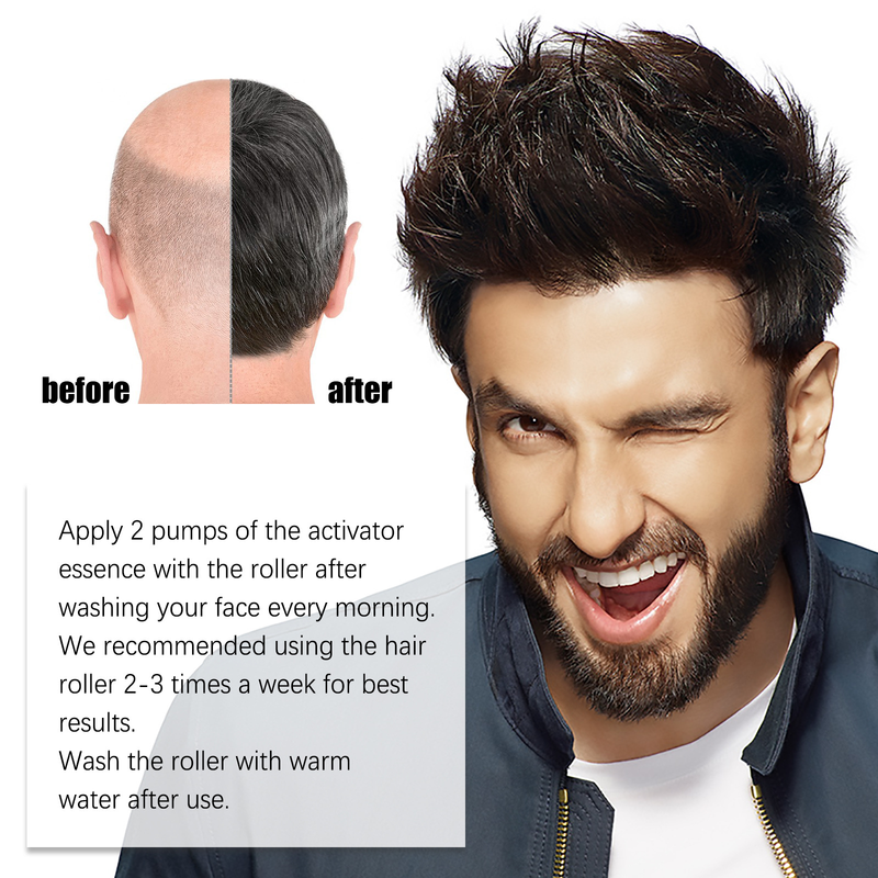 Jaysuing Scalp favorise l'épaississement du peigne à cheveux de massage à rouleaux_voghion.com