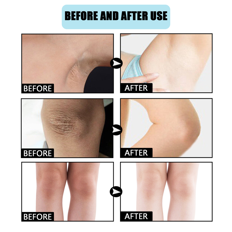 Whitening Cream Bleken Gezicht Lichaam Verhelderende Crème Onderarm Whitening Cream Benen Knieën Privégedeelte voor Lichaam Wit 60m Vrouw _voghion.com