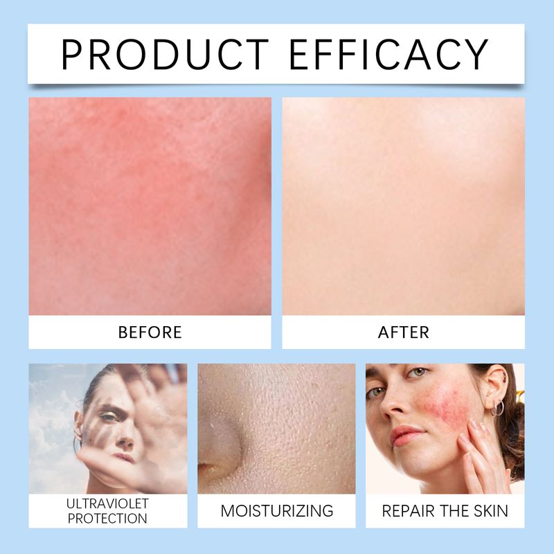 Hoygi Ceramide Protective Cream, Refreshing And Moisturizing In Summer, Protects Skin, Restores Uv Isolation And Prevents Sweat_voghion.com