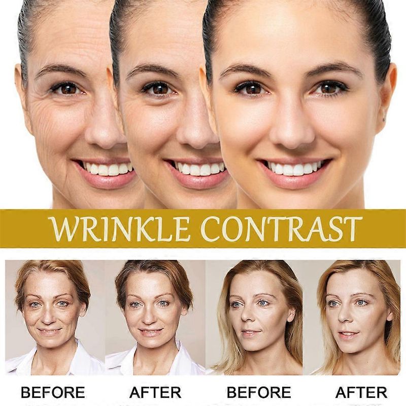 2Pcs Advanced Bee-Venom Serum Anti-Aging Moisturizer For Face And Neck Nourishing_voghion.com