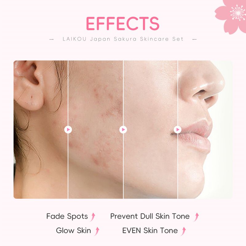 Laike Jaapani Sakura nahahooldustoodete komplekt 4-osaline puhastusvahend Essence Eye Cream näokreem_voghion.com