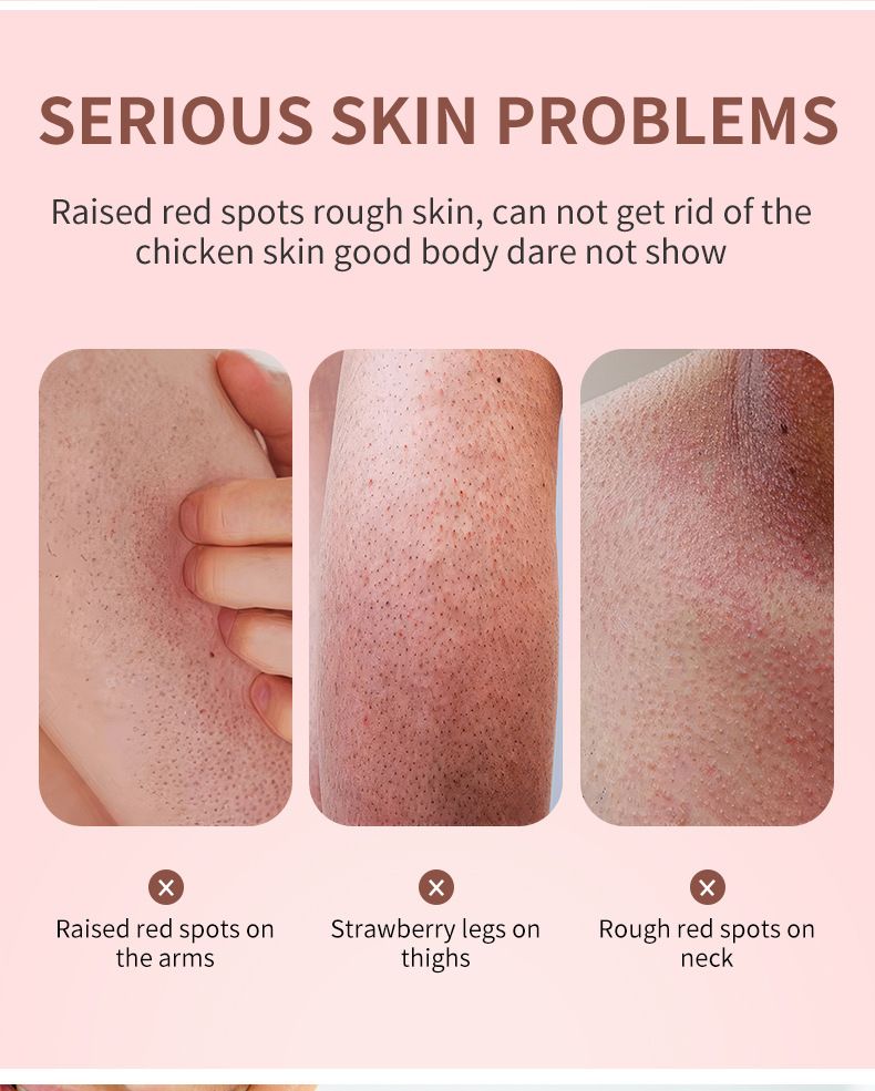 poulet Enlever la lotion pour la peau Crème de massage pour le corps_voghion.com