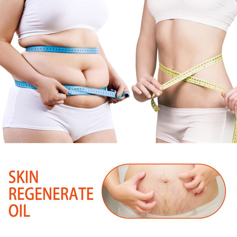 Repair Ja, Tighten Abdomen, Massage Shape The Body, Smooth Moisturize Scars, Fade Stretch Marks, And Use Oil_voghion.com