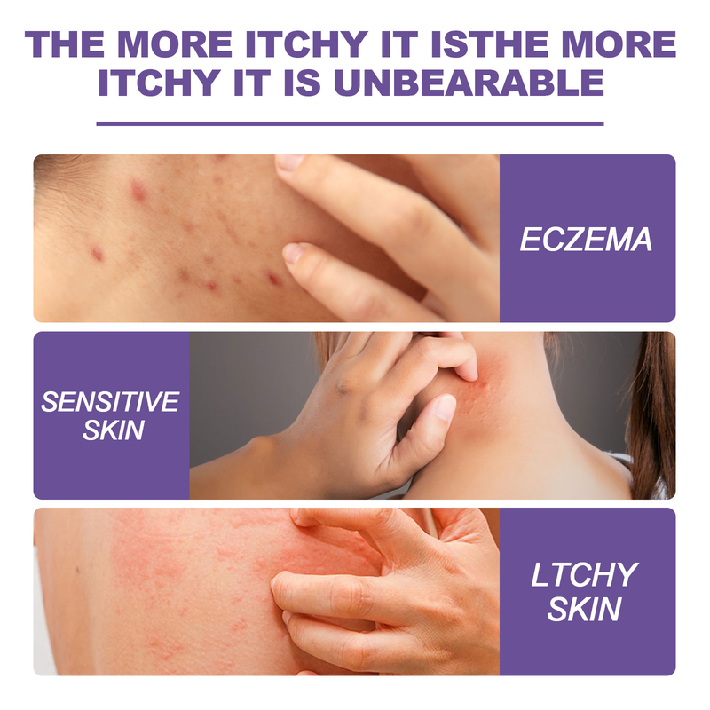EELHOE Skin Repair Cream käte jalasambla parandamiseks, sügeluse ja punetuse leevendamiseks ning niisutav nahahoolduskreem_voghion.com
