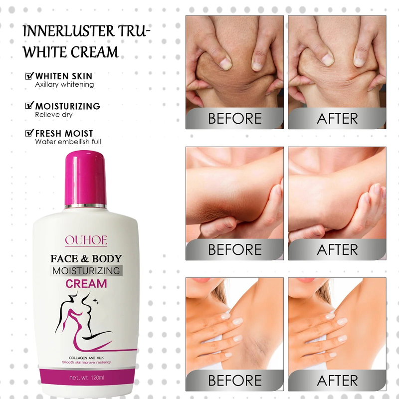 Creme corporal clareador para áreas íntimas brilhantes e escuras da pele, clareamento de partes íntimas, loção hidratante iluminadora para axilas_voghion.com