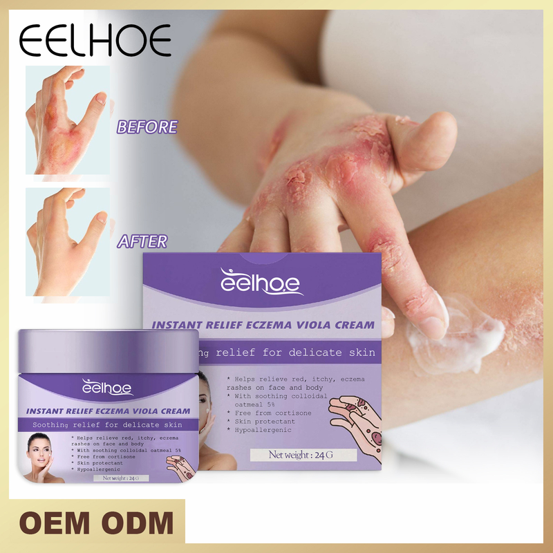 EELHOE Skin Repair Cream käte jalasambla parandamiseks, sügeluse ja punetuse leevendamiseks ning niisutav nahahoolduskreem_voghion.com
