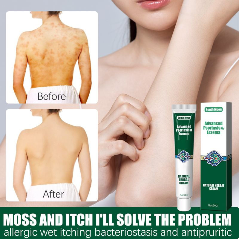 South Moon Skin Topical Cream Moisturizing and Moisturizing, Reducing Itching Herbal Ointment_voghion.com