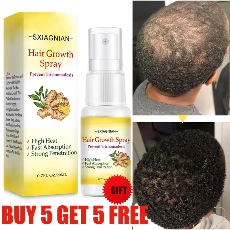Ginger Fast Hair Growth Serum Spray Regrowth Essence Oil Hiustenlähtöä estävät tuotteet ehkäisevät kaljuuntumista Päänahan hoito Kauneus terveys_voghion.com