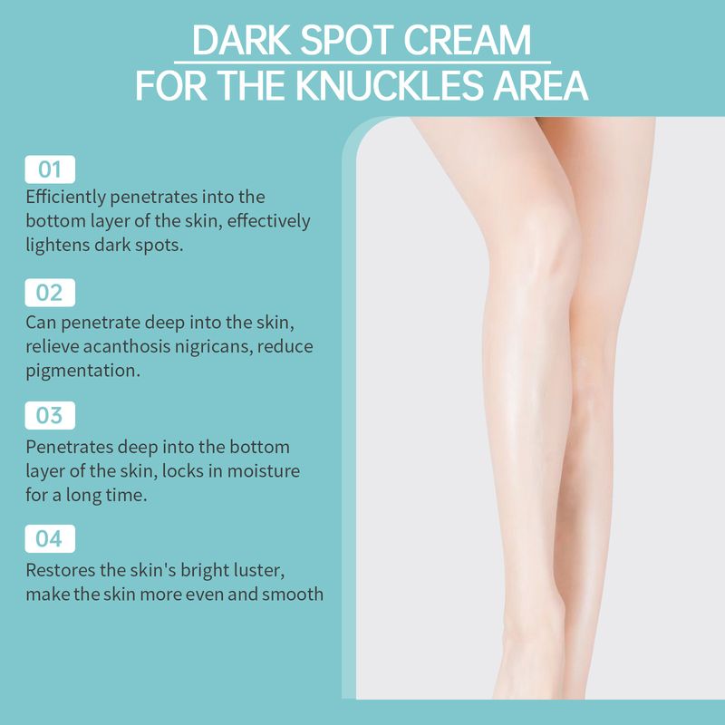 Cremă pentru pielea genunchilor, Masaj pentru pielea genunchilor Cremă hidratantă pentru îngrijirea corpului_voghion.com