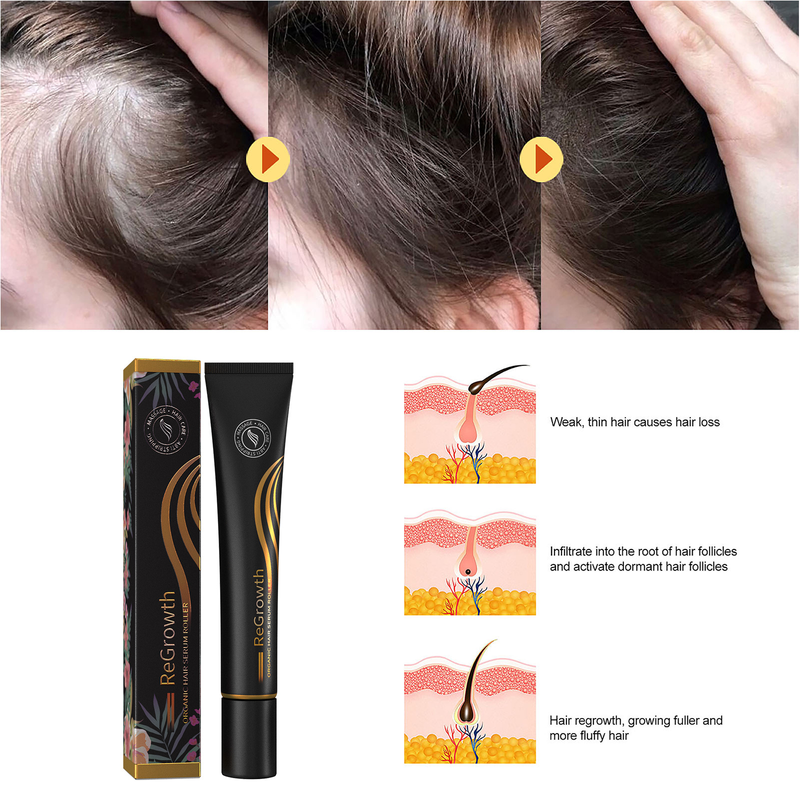 Capelli 1PCS Set di rulli per siero per la ricrescita Siero per la crescita dei capelli Triple Roll-On Massaggiatore Essenza per la crescita dei capelli per le donne degli uomini_voghion.com