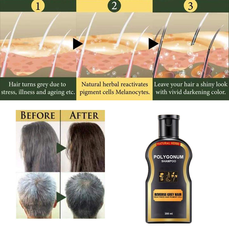 Șampon Polygonum multiflorum Beautiful Șampon pentru îngrijirea părului negru Șampon de curățare, hrănire și netezire_voghion.com