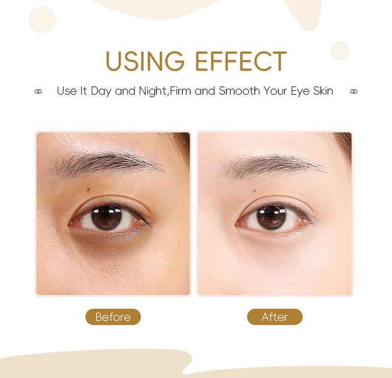 LAIKOU Red Ginseng Snail Eye Cream 15g Hydrating And Moisturizing To Protect Eye Skin_voghion.com