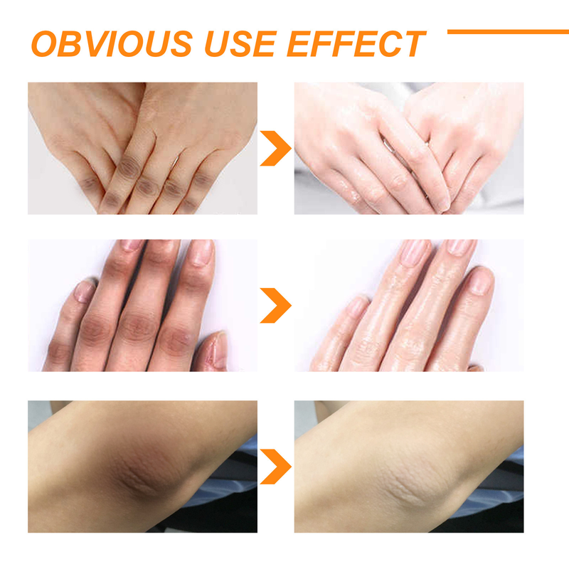 Orange Peel Eelhoe Exfoliating for Removing Black, White, Moisturizing, Brightening Skin, and Desalinating Mel_voghion.com