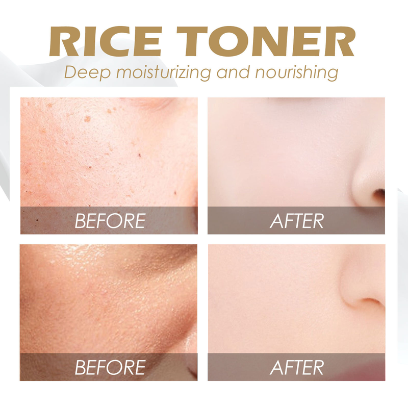 Rijsttoner Mooi om acnevlekken, vlekken te verlichten, acne te verstevigen, poriën aan te vullen, te hydrateren en de huid witter te maken_voghion.com