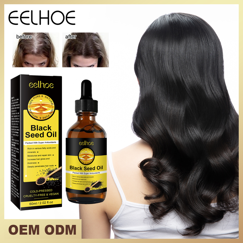 l'olio di semi neri può migliorare la secchezza irritabile, nutrire, riparare i danni, prevenire la caduta dei capelli, capelli densi ed essenziali,_voghion.com