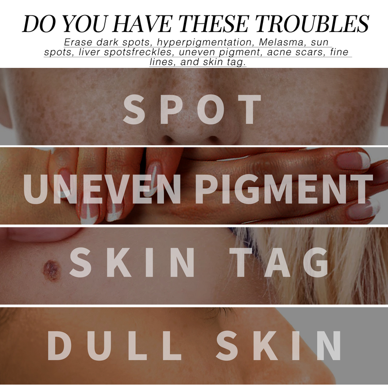 West&Month Freckle Repair essents kortsudevastane, õrn valgendab nahka, pleegitab näokortsud, peened jooned ja laigud_voghion.com