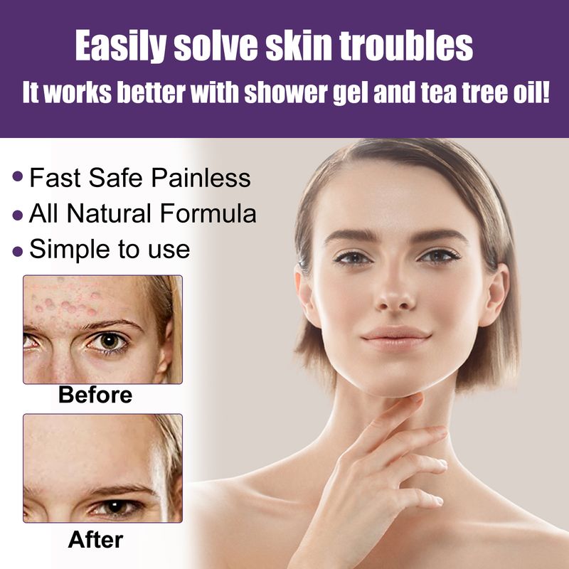 South Moon Skin Cleaning Removal of Under Arms Hand and Foot Anti Wart Flat Care Liquid Set Zestaw do czyszczenia skóry dłoni i stóp_voghion.com