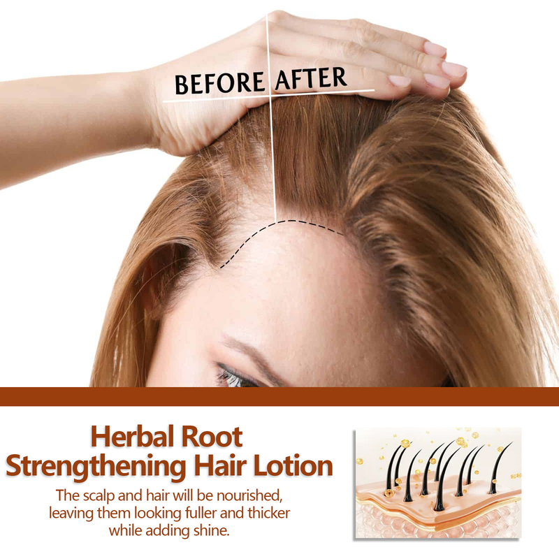 Herbal Root EELHOE lotion Fixing Dense Line Repairing, Tough, Moisturizing, Hair Loss Prevention_voghion.com