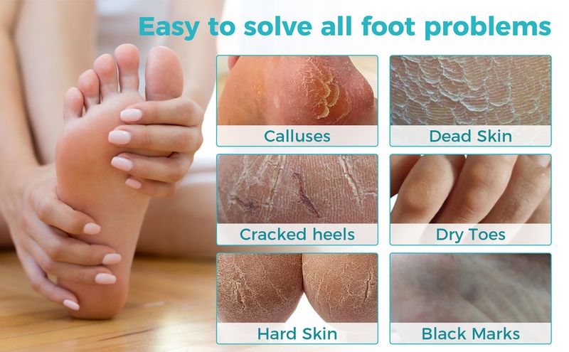 Foot Care Hot Product Plant OUKEYA 4 In 1 Hydrating, Moisturizing, Exfoliating And Caring Foot Mask English Version_voghion.com