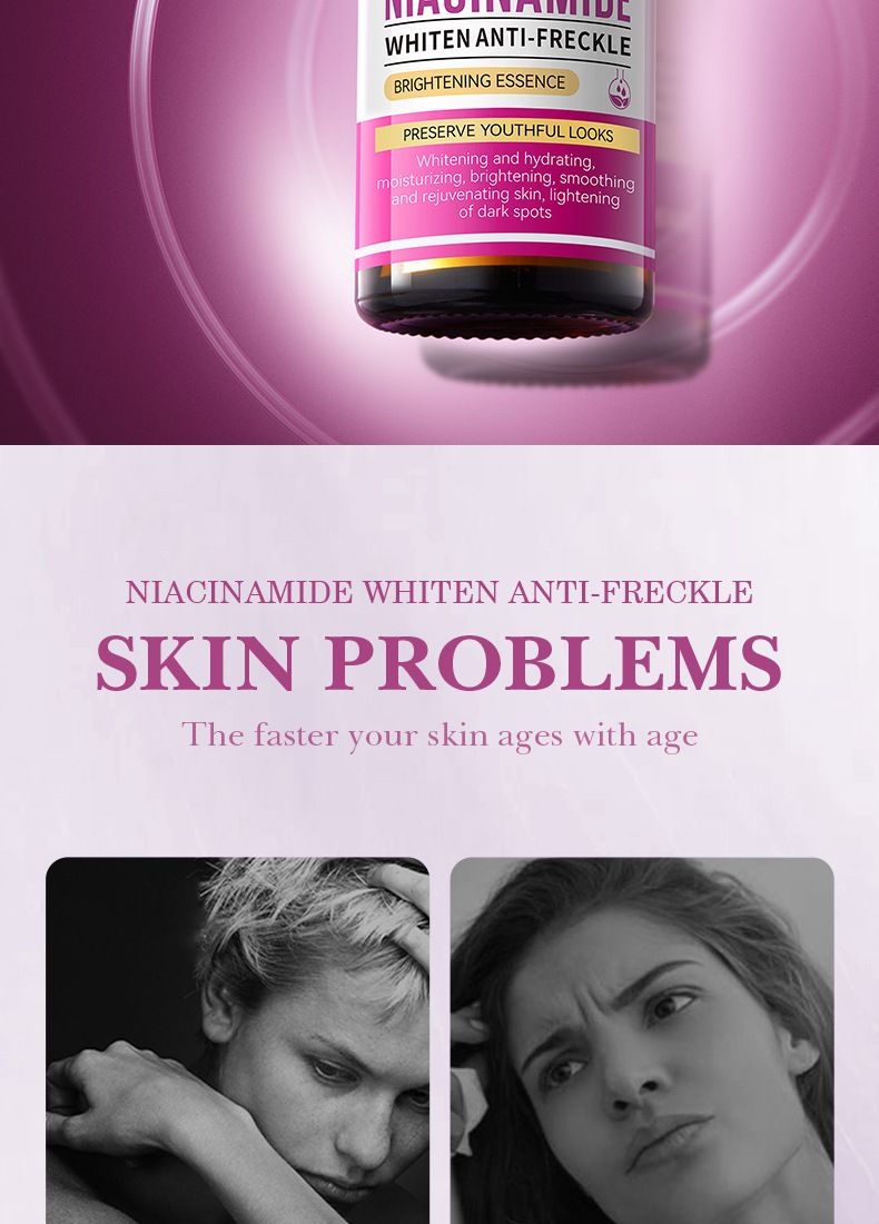 SADOER Niacinamide Whitening And Freckle Removal Serum, Hydrating And Moisturizing Pores_voghion.com